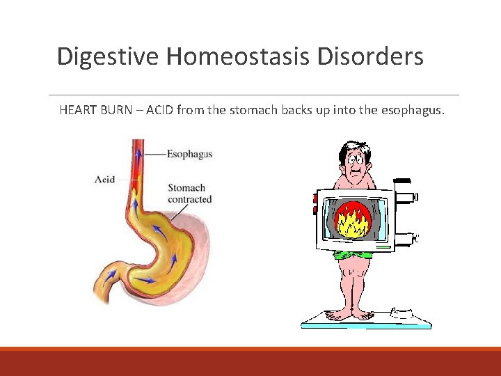 Digestive Homeostasis Disorders HEART BURN – ACID from the stomach backs up into the