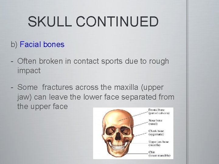 SKULL CONTINUED b) Facial bones - Often broken in contact sports due to rough