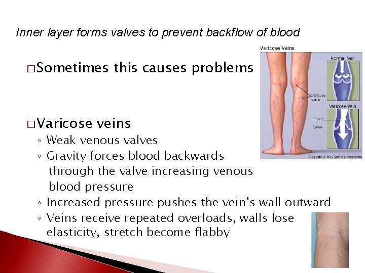 Inner layer forms valves to prevent backflow of blood � Sometimes � Varicose this