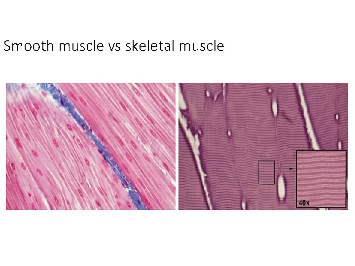 Smooth muscle vs skeletal muscle Smooth muscle vs skeletal muscle