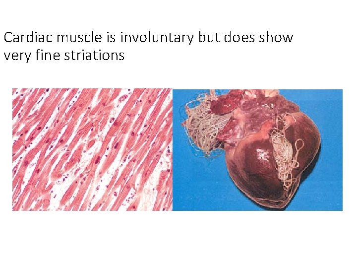 Cardiac muscle is involuntary but does show very fine striations Cardiac muscle is involuntary but does show very fine striations