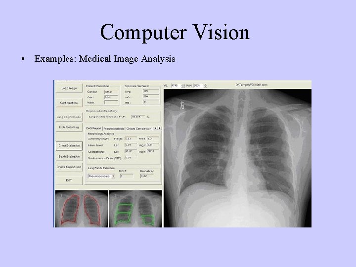 Computer Vision • Examples: Medical Image Analysis 