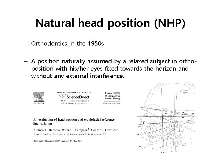 Natural head position (NHP) – Orthodontics in the 1950 s – A position naturally