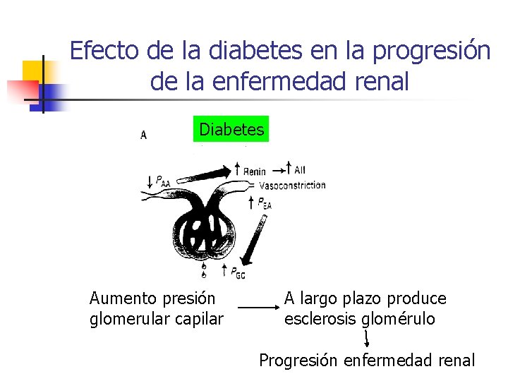 Efecto de la diabetes en la progresión de la enfermedad renal Diabetes Aumento presión