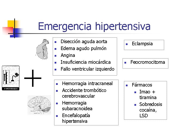 Emergencia hipertensiva n n n n n Disección aguda aorta Edema agudo pulmón Angina