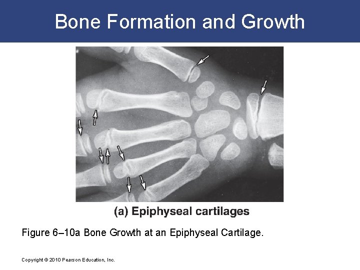 Bone Formation and Growth Figure 6– 10 a Bone Growth at an Epiphyseal Cartilage.