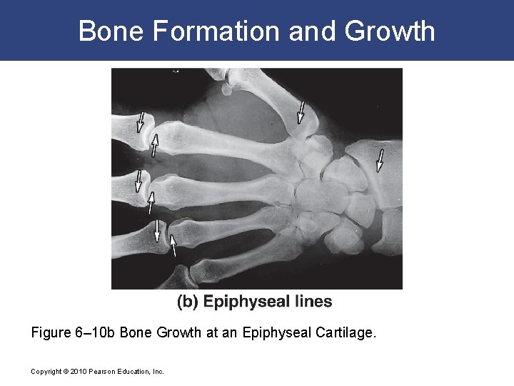 Bone Formation and Growth Figure 6– 10 b Bone Growth at an Epiphyseal Cartilage.