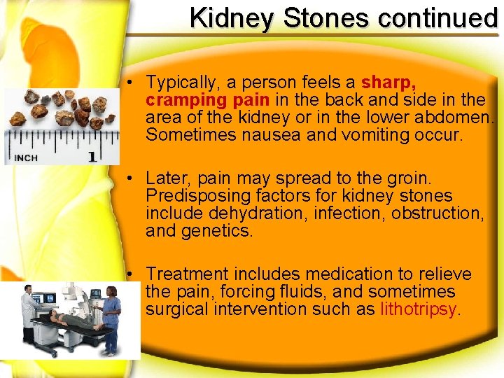Kidney Stones continued • Typically, a person feels a sharp, cramping pain in the
