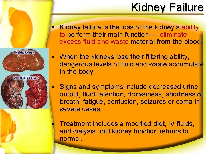 Kidney Failure • Kidney failure is the loss of the kidney’s ability to perform