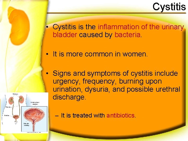 Cystitis • Cystitis is the inflammation of the urinary bladder caused by bacteria. •