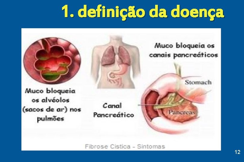 1. definição da doença 12 