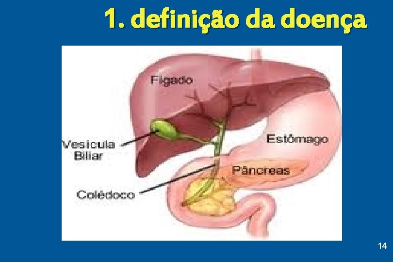 1. definição da doença 14 