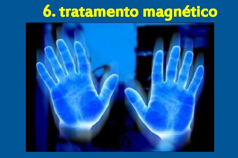 6. tratamento magnético 