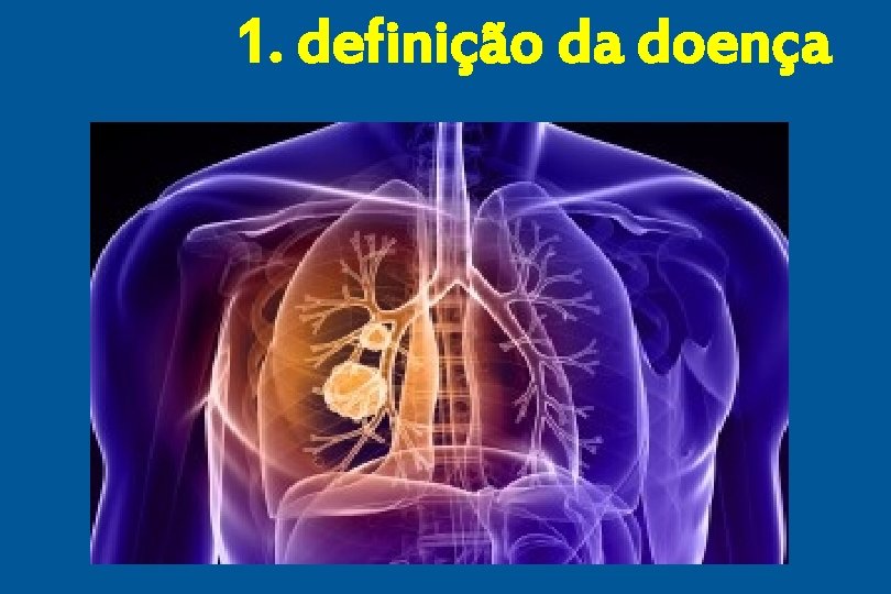 1. definição da doença 