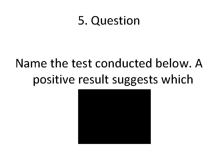 5. Question Name the test conducted below. A positive result suggests which disease? 