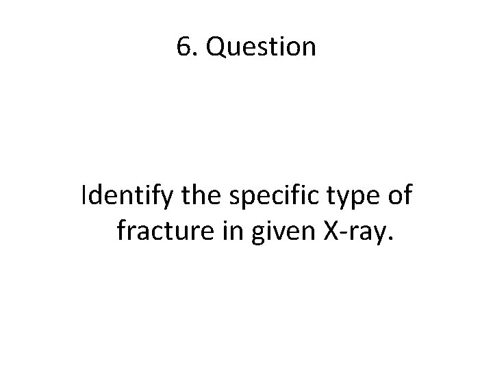 6. Question Identify the specific type of fracture in given X-ray. 