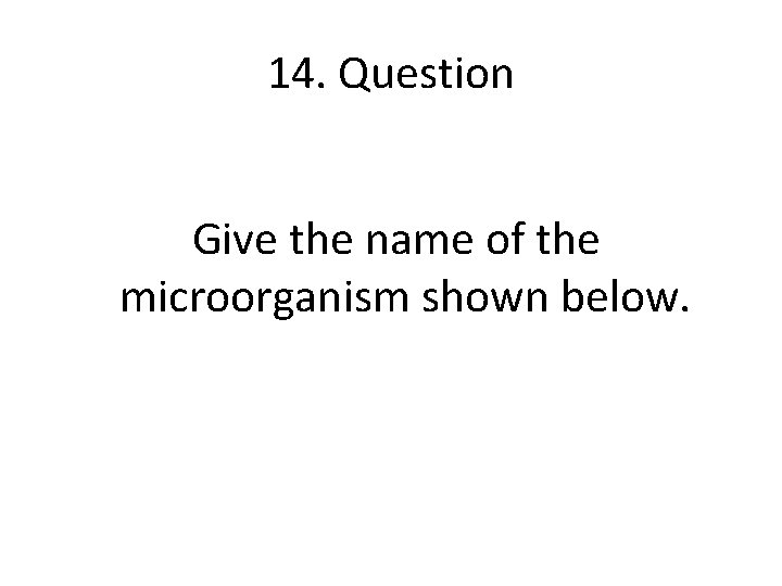 14. Question Give the name of the microorganism shown below. 