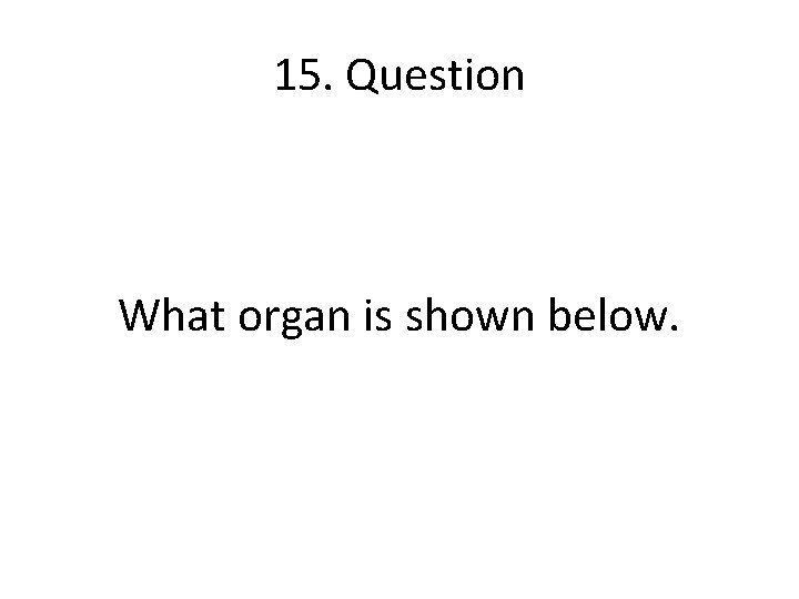 15. Question What organ is shown below. 