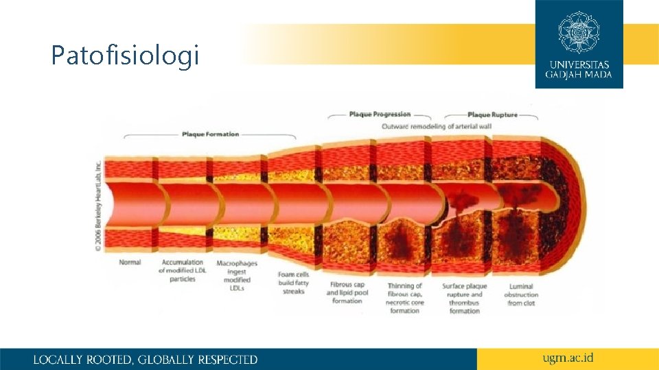 Patofisiologi 