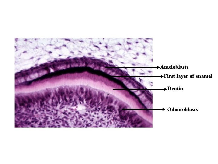 Ameloblasts First layer of enamel Dentin Odontoblasts 