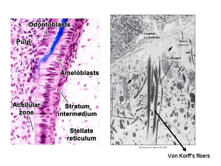 Von Korff’s fibers 