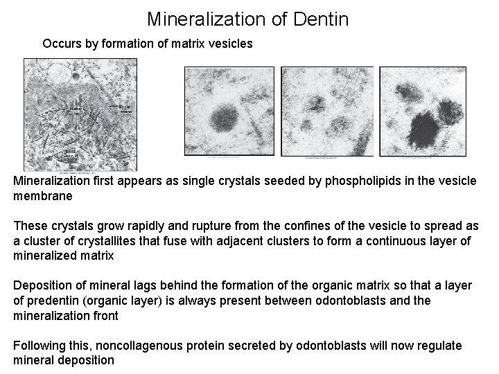 Mineralization of Dentin Occurs by formation of matrix vesicles Mineralization first appears as single