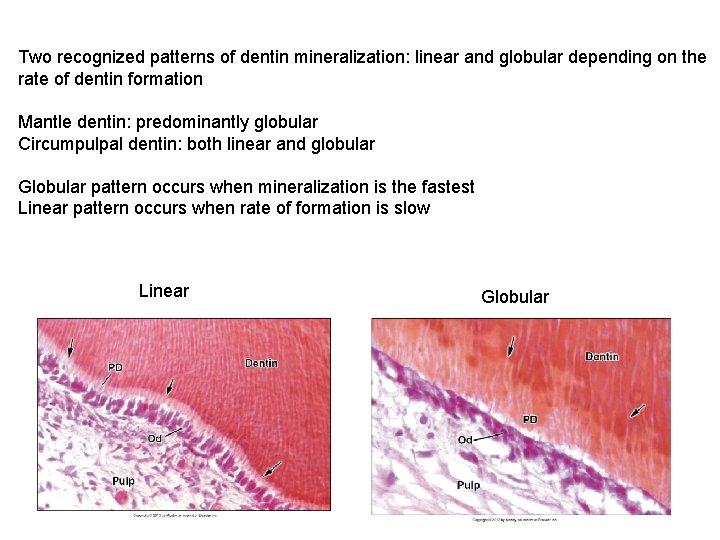 Two recognized patterns of dentin mineralization: linear and globular depending on the rate of