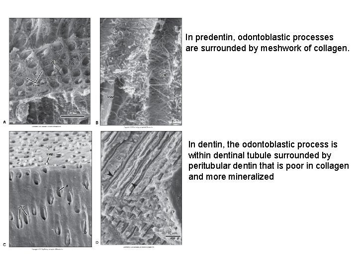 In predentin, odontoblastic processes are surrounded by meshwork of collagen. In dentin, the odontoblastic