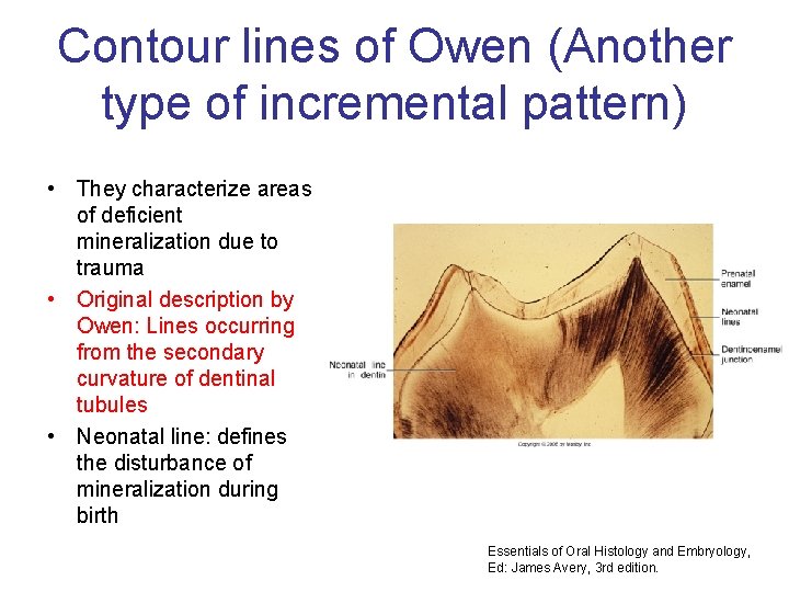 Contour lines of Owen (Another type of incremental pattern) • They characterize areas of