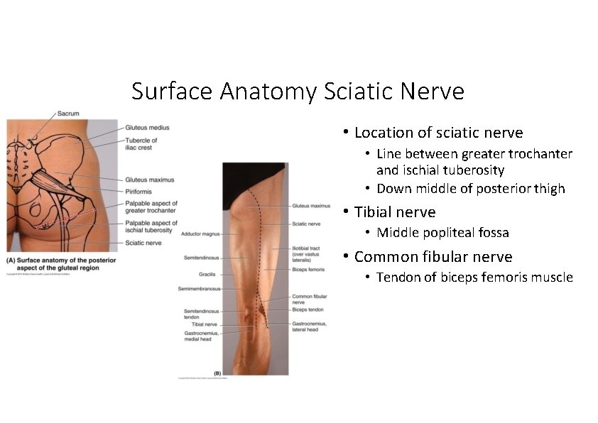 Surface Anatomy Sciatic Nerve • Location of sciatic nerve • Line between greater trochanter