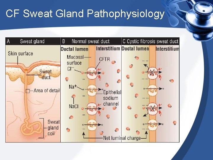 CF Sweat Gland Pathophysiology 