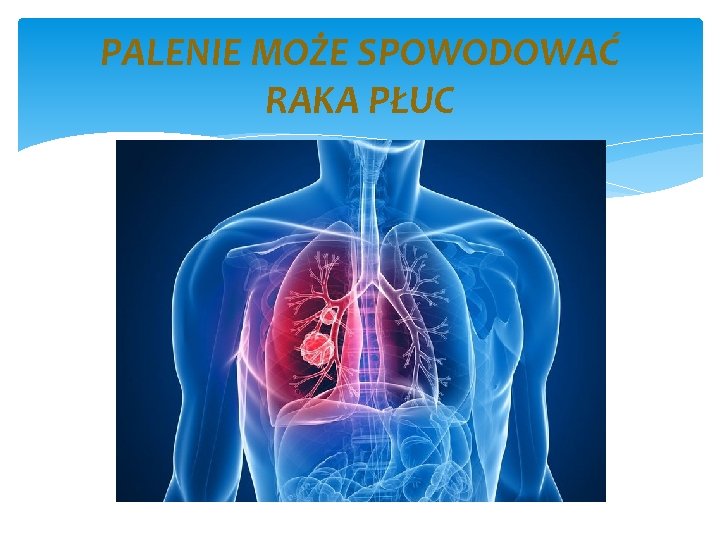PALENIE MOŻE SPOWODOWAĆ RAKA PŁUC 