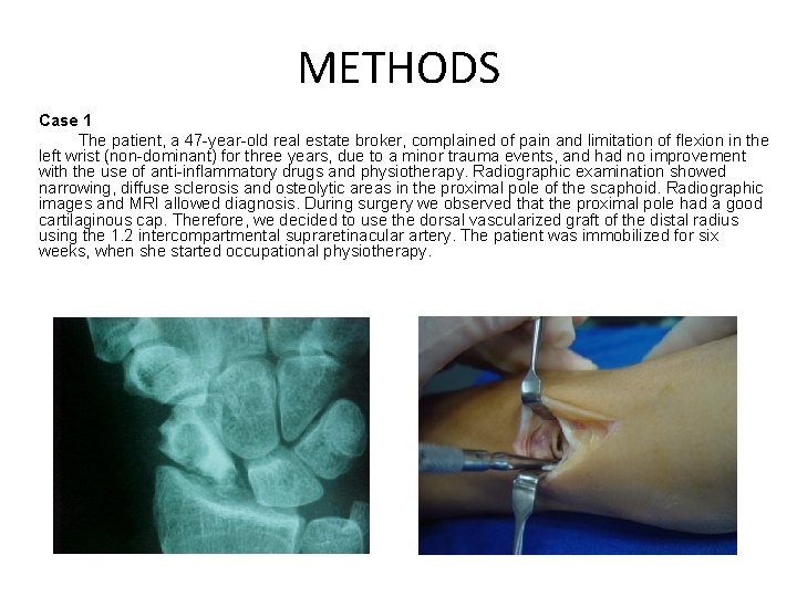 METHODS Case 1 The patient, a 47 -year-old real estate broker, complained of pain