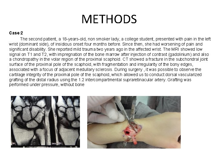 METHODS Case 2 The second patient, a 18 -years-old, non smoker lady, a college