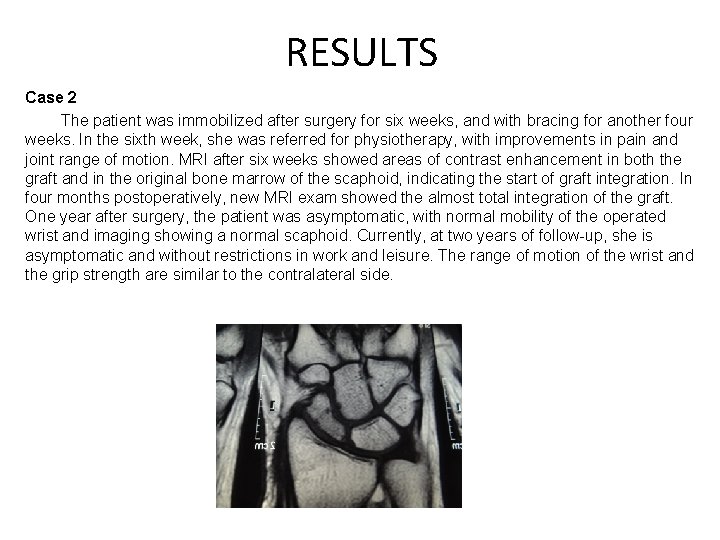 RESULTS Results Case 2 The patient was immobilized after surgery for six weeks, and