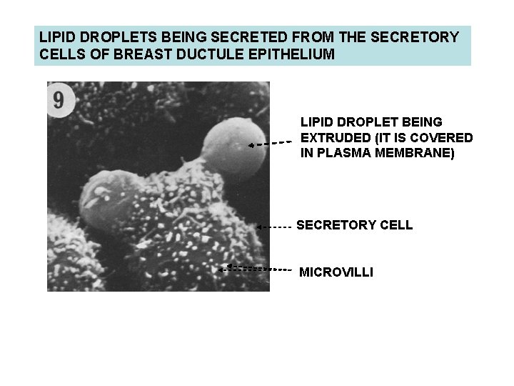 LIPID DROPLETS BEING SECRETED FROM THE SECRETORY CELLS OF BREAST DUCTULE EPITHELIUM LIPID DROPLET