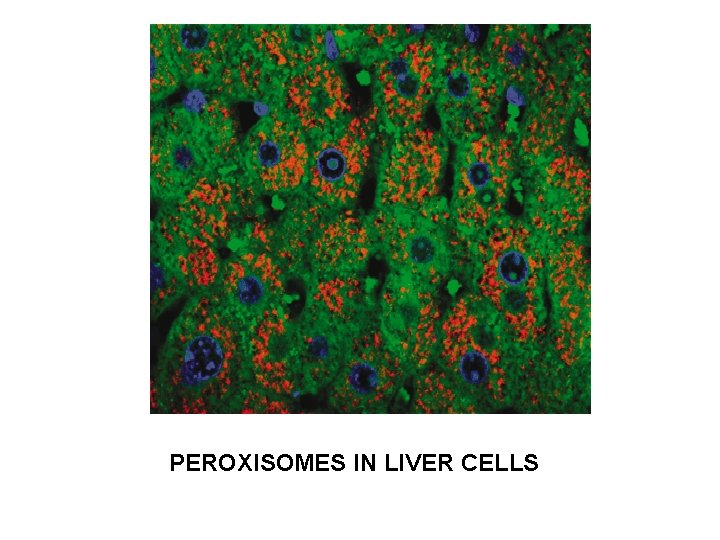 PEROXISOMES IN LIVER CELLS 