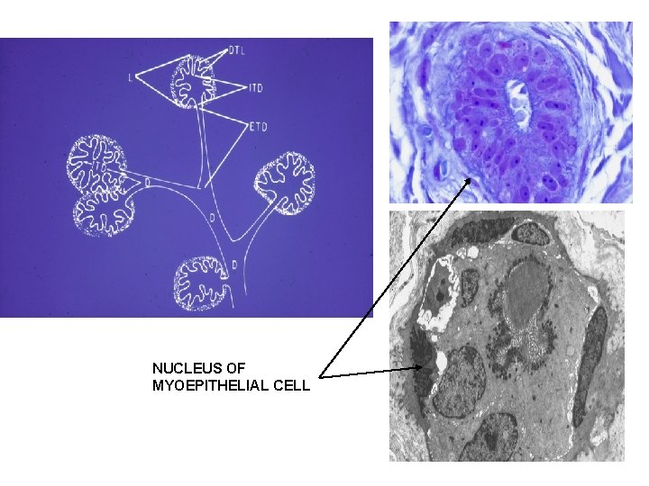 NUCLEUS OF MYOEPITHELIAL CELL 