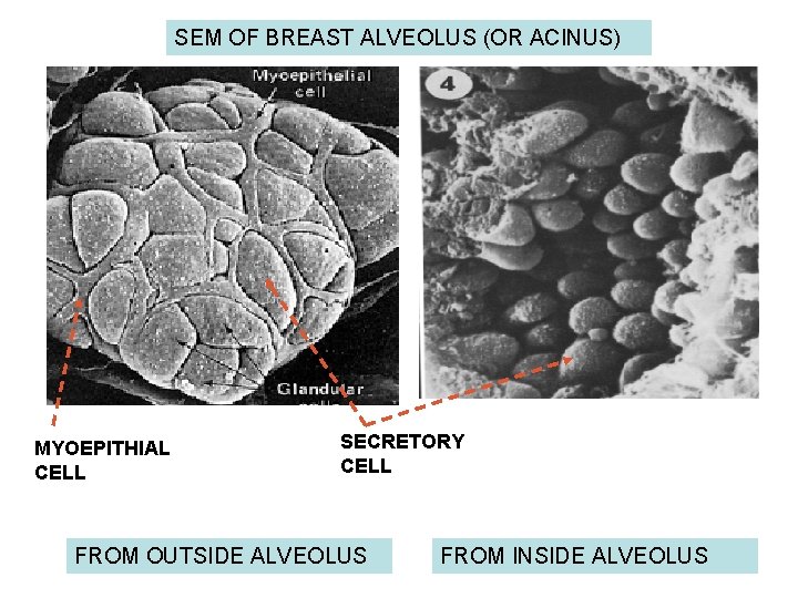 SEM OF BREAST ALVEOLUS (OR ACINUS) MYOEPITHIAL CELL SECRETORY CELL FROM OUTSIDE ALVEOLUS FROM
