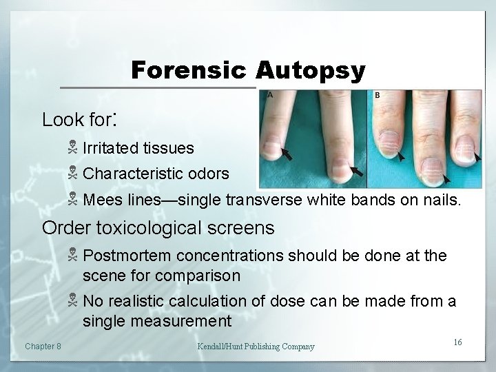 Forensic Autopsy Look for: N Irritated tissues N Characteristic odors N Mees lines—single transverse