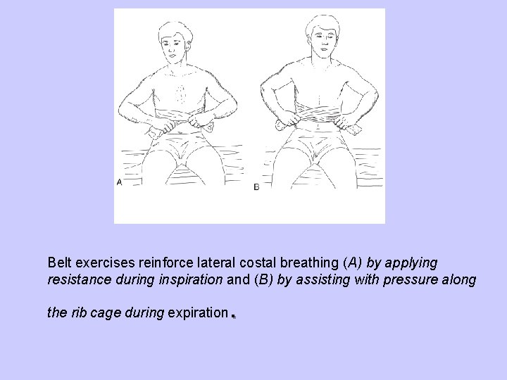 Belt exercises reinforce lateral costal breathing (A) by applying resistance during inspiration and (B)