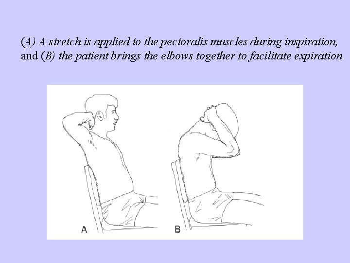 (A) A stretch is applied to the pectoralis muscles during inspiration, and (B) the