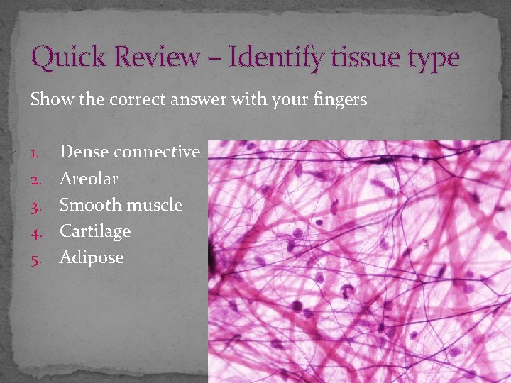 Quick Review – Identify tissue type Show the correct answer with your fingers 1.