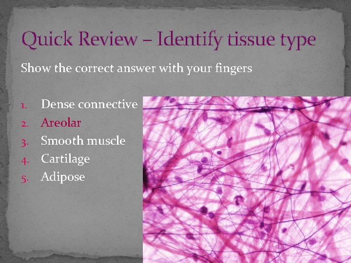 Quick Review – Identify tissue type Show the correct answer with your fingers 1.