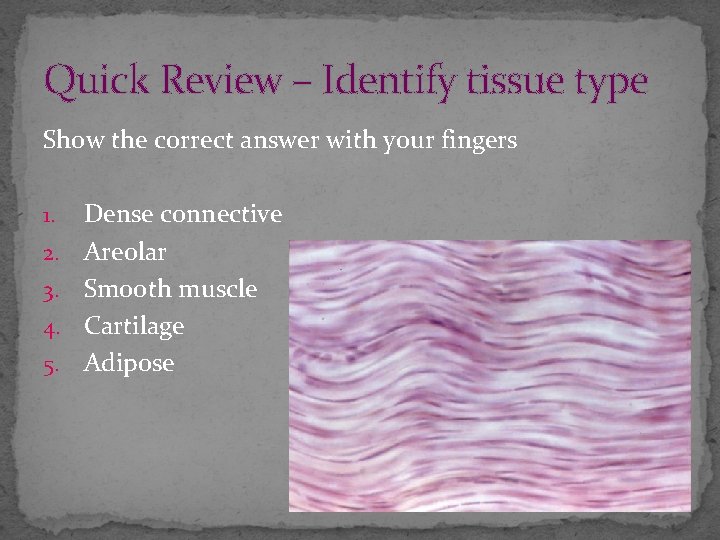 Quick Review – Identify tissue type Show the correct answer with your fingers 1.