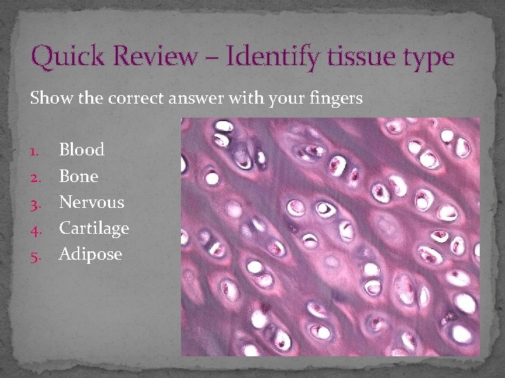 Quick Review – Identify tissue type Show the correct answer with your fingers 1.