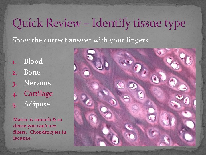 Quick Review – Identify tissue type Show the correct answer with your fingers 1.