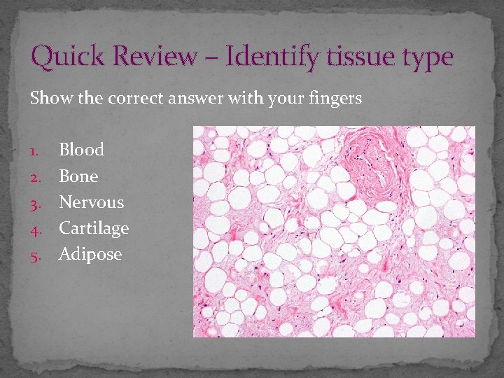 Quick Review – Identify tissue type Show the correct answer with your fingers 1.