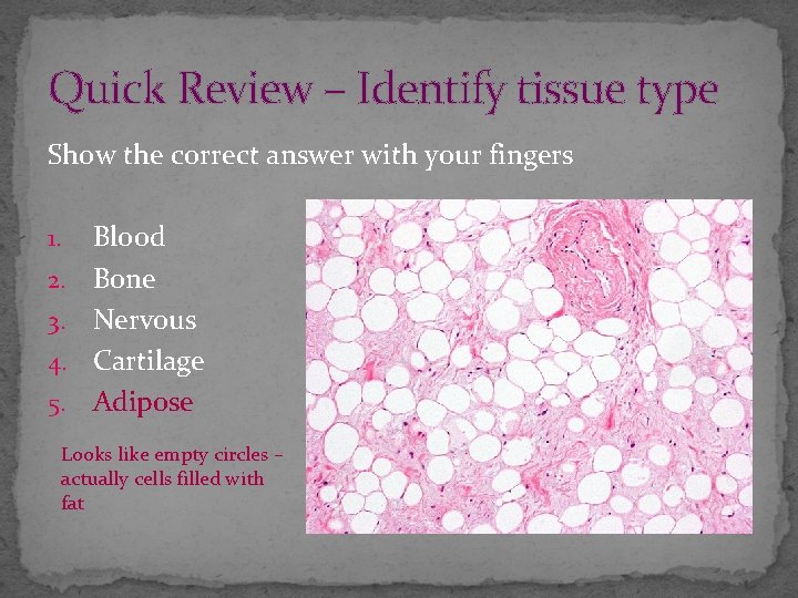 Quick Review – Identify tissue type Show the correct answer with your fingers 1.