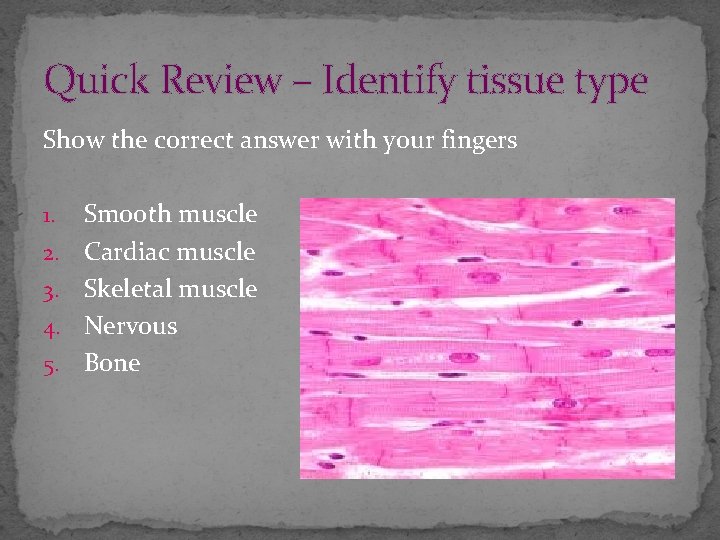 Quick Review – Identify tissue type Show the correct answer with your fingers 1.